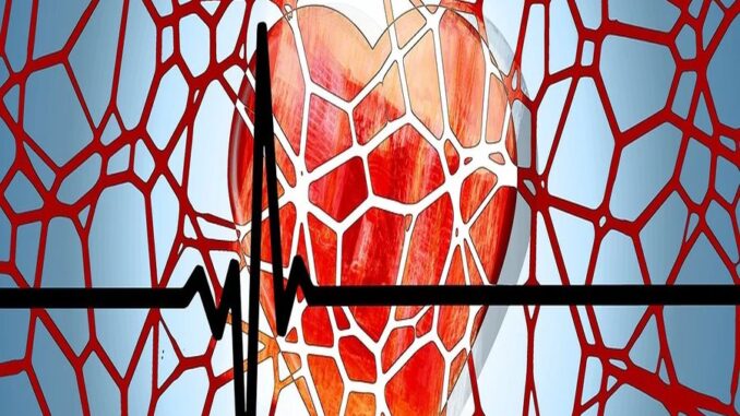 Zdroj foto: Pixabay.com